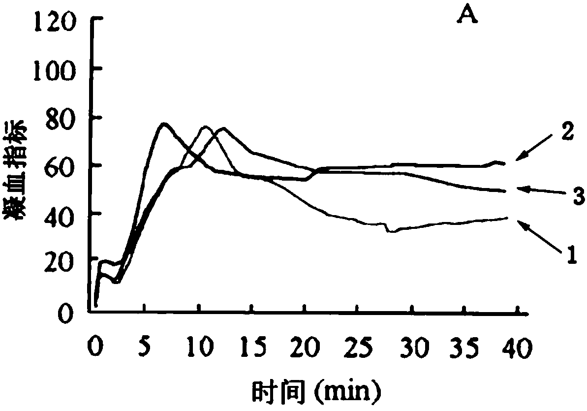 Hydroxyethyl starch injection composition as well as preparation method and application of hydroxyethyl starch injection composition