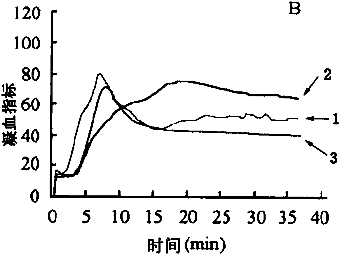 Hydroxyethyl starch injection composition as well as preparation method and application of hydroxyethyl starch injection composition