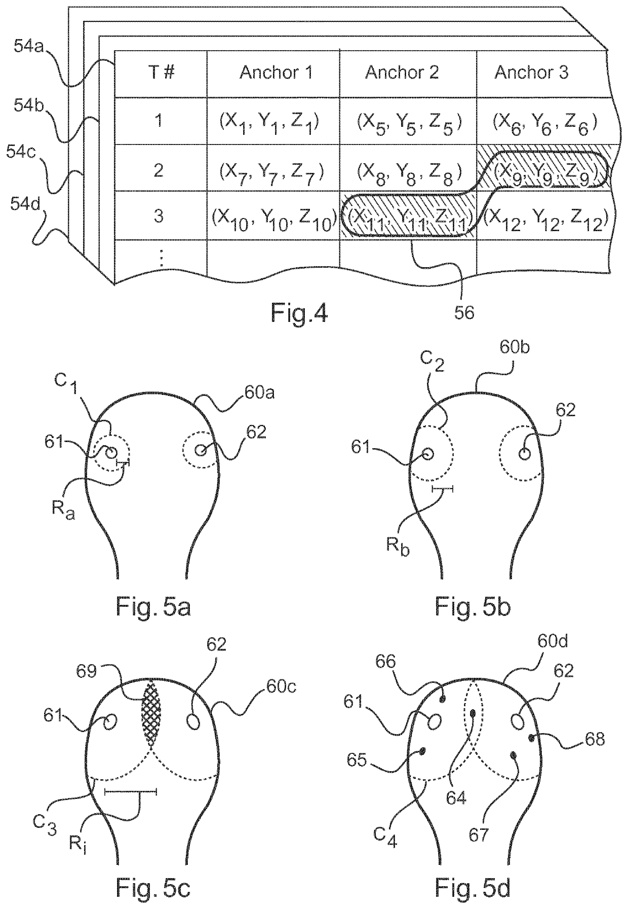 Planning of surgical anchor placement location data