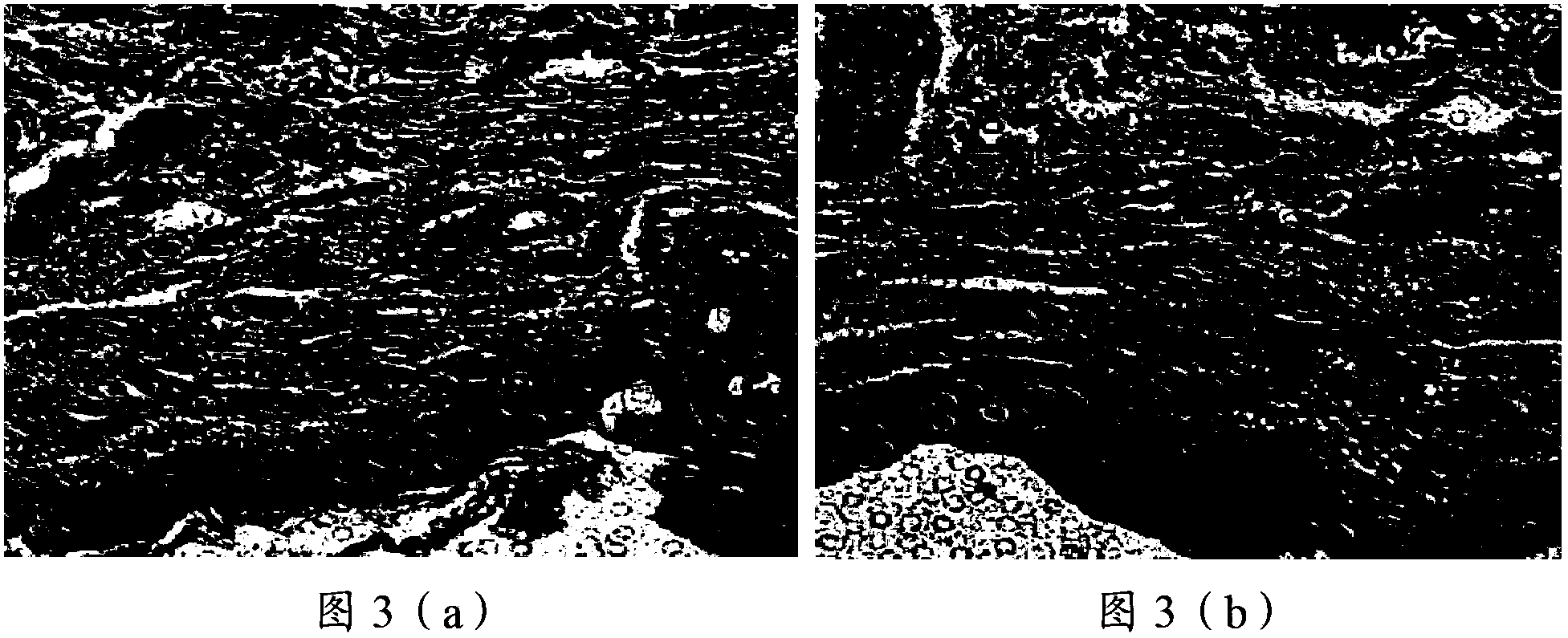 A liraglutide in-situ gel preparation and a preparing method thereof