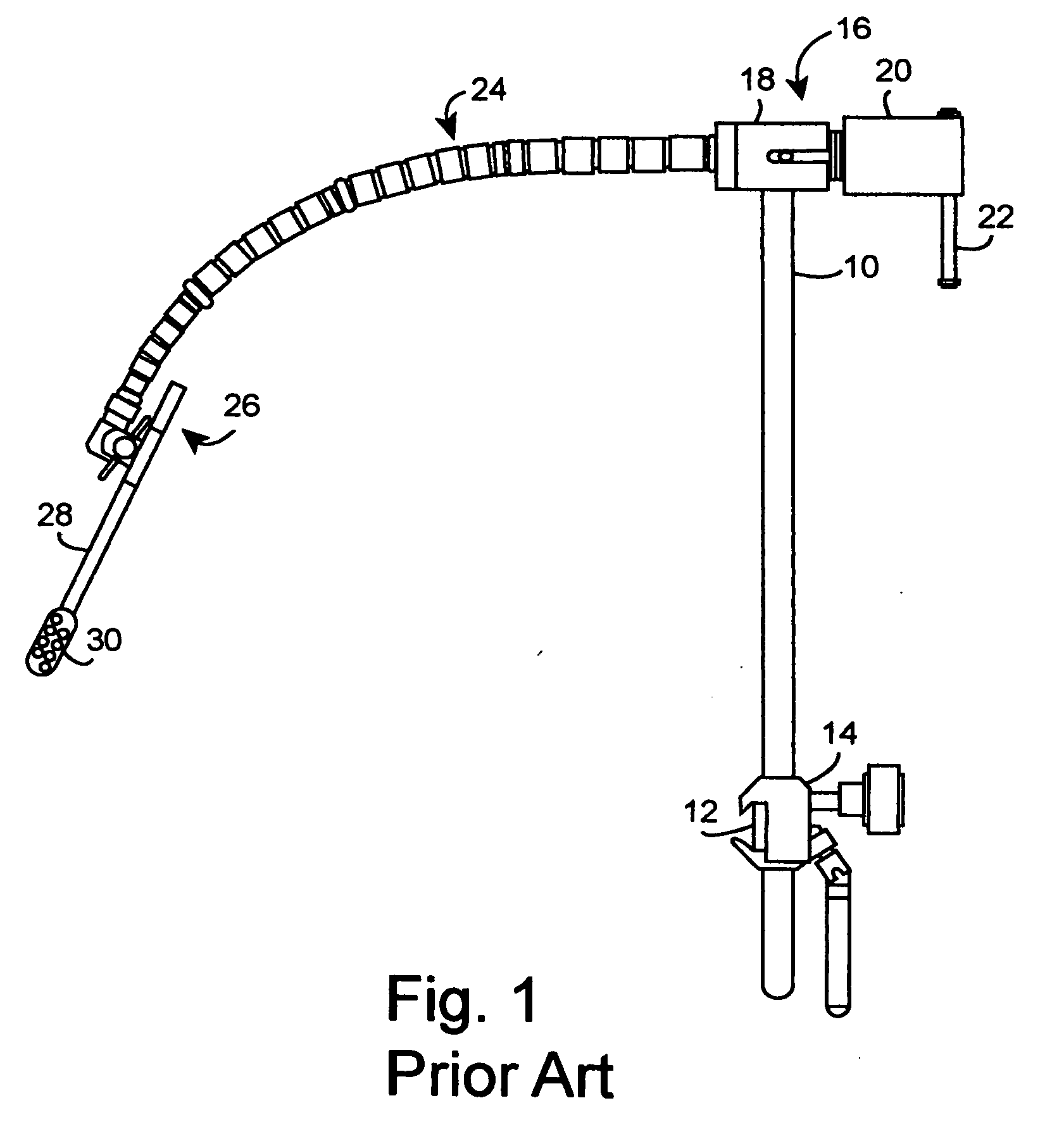 Method and apparatus for improved stiffness in the linkage assembly of a flexible arm