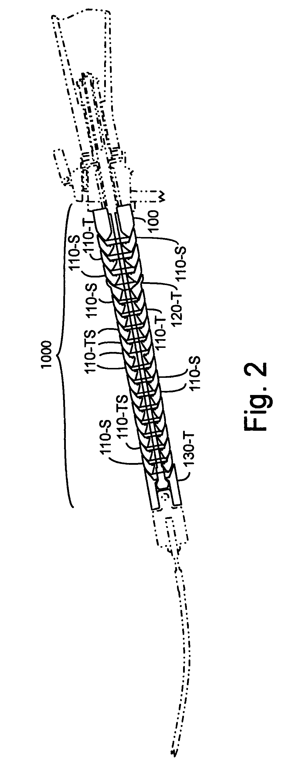 Method and apparatus for improved stiffness in the linkage assembly of a flexible arm