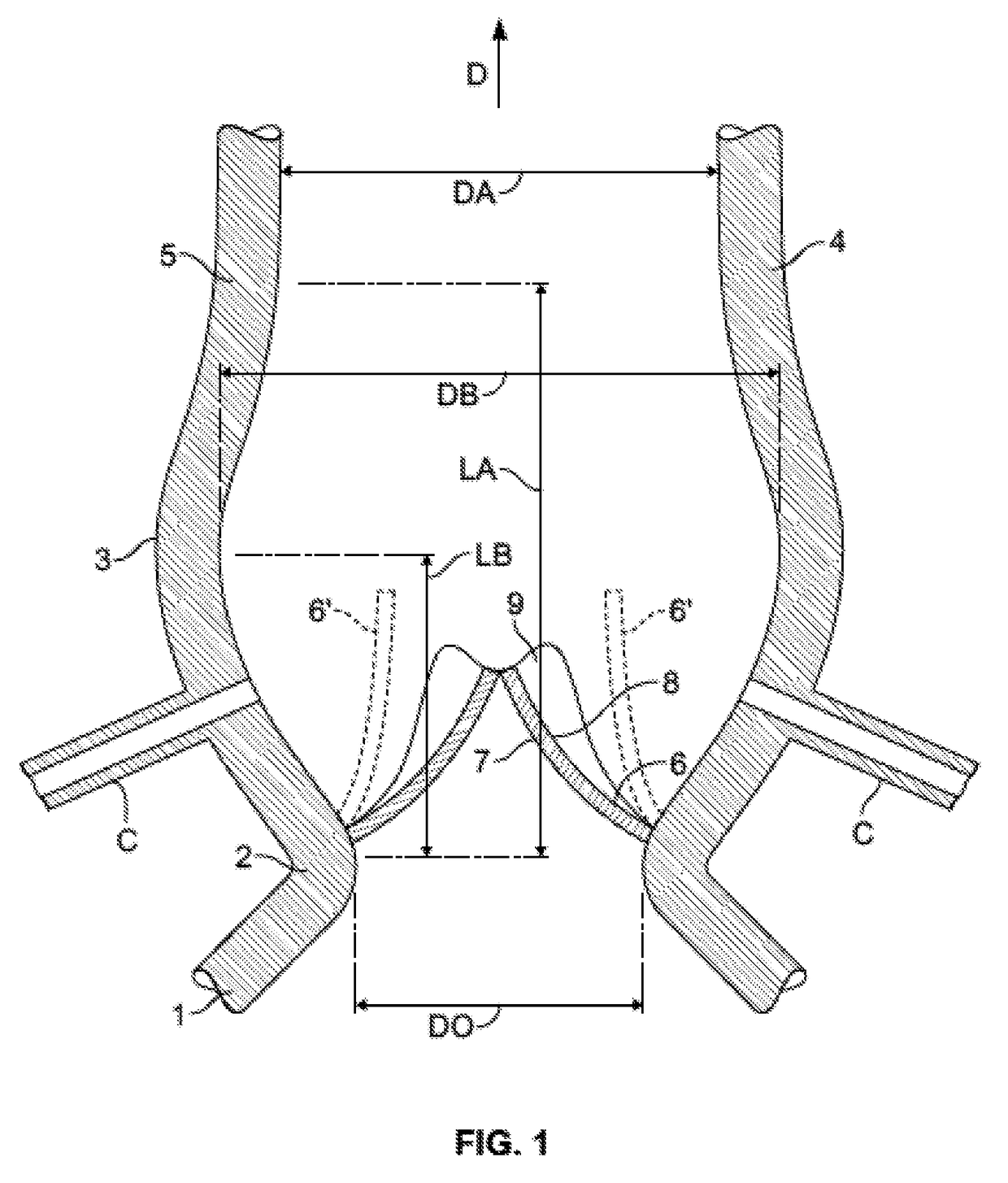 Transcatheter valve stent anchors