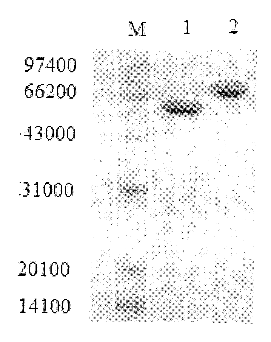 Kit and method for clinically detecting serum or plasma free fatty acid