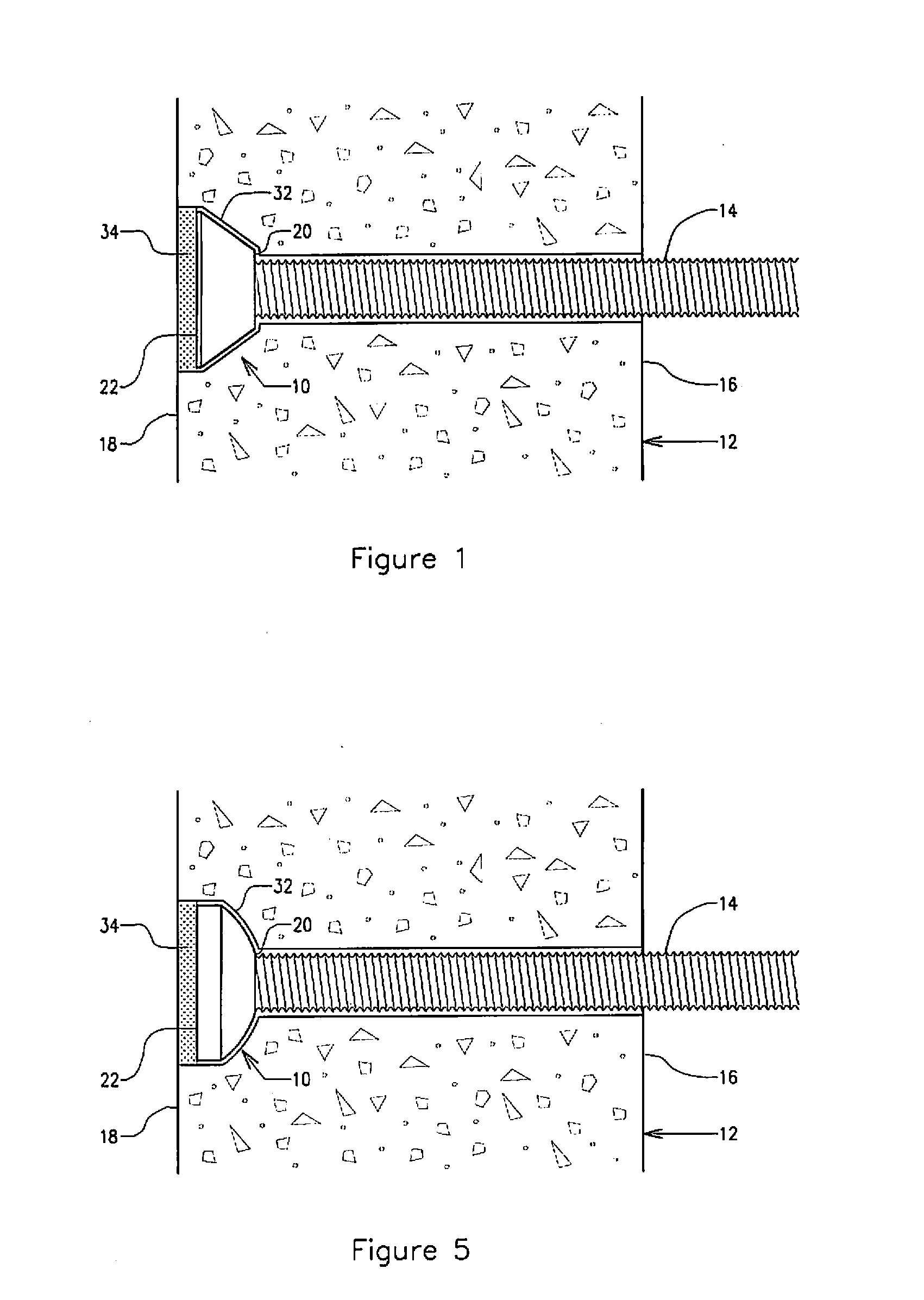 Post installed concealable concrete anchor