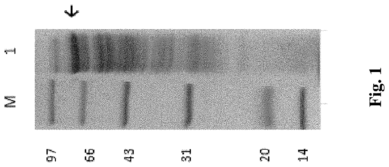 Method for preparing resistant dextrin by using a starch branching enzyme and a cyclodextrin glycosyltransferase