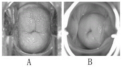 Traditional Chinese medicine compound preparation for treating gynecological inflammations and preparation method thereof