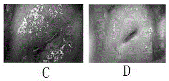 Traditional Chinese medicine compound preparation for treating gynecological inflammations and preparation method thereof