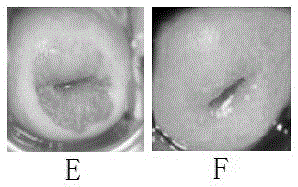 Traditional Chinese medicine compound preparation for treating gynecological inflammations and preparation method thereof