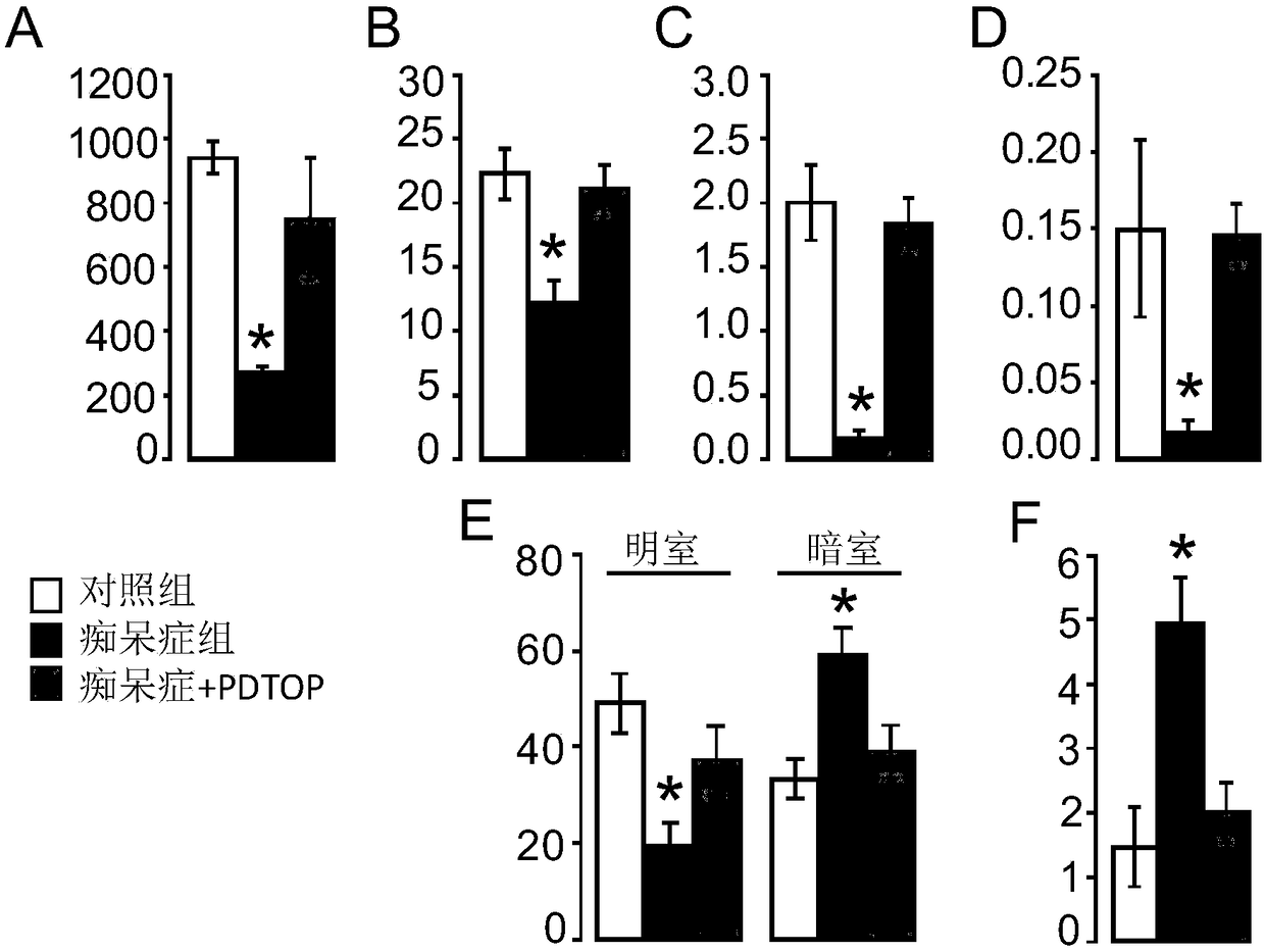 A kind of phenol theophyllic acid and its preparation method and application