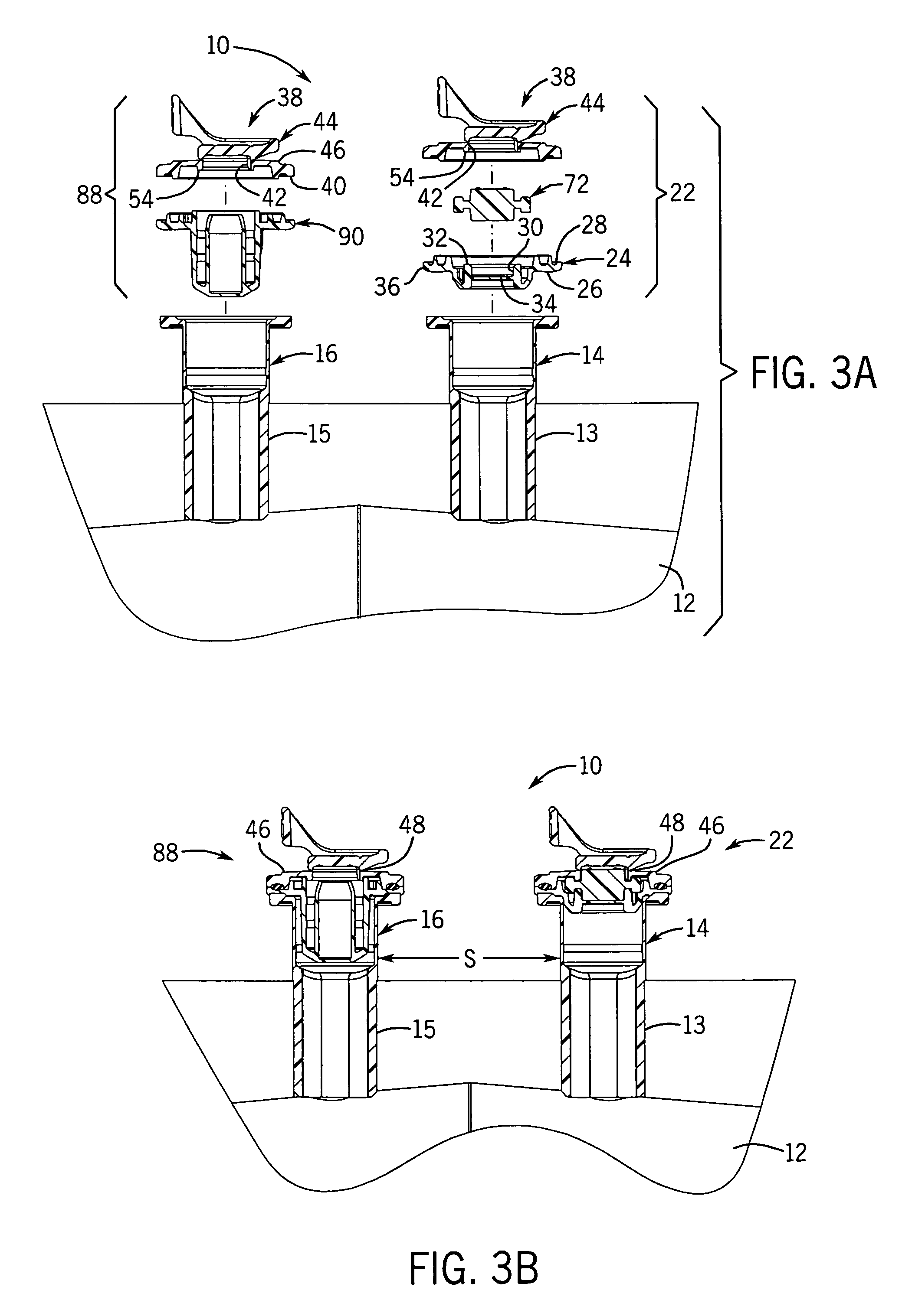 Medical fluid container with concave side weld