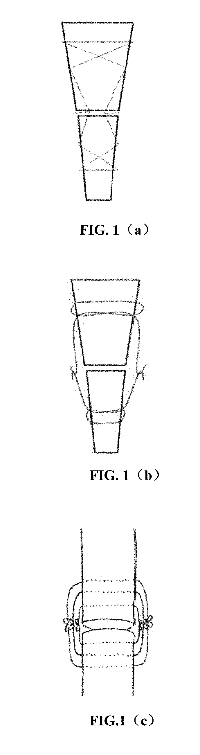 Achilles tendon suture apparatus and method of using same