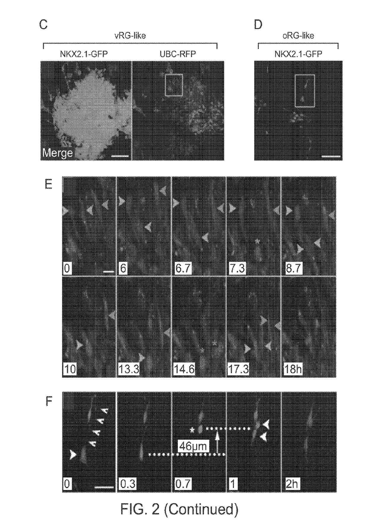 In vitro production of medial ganglionic eminence precursor cells