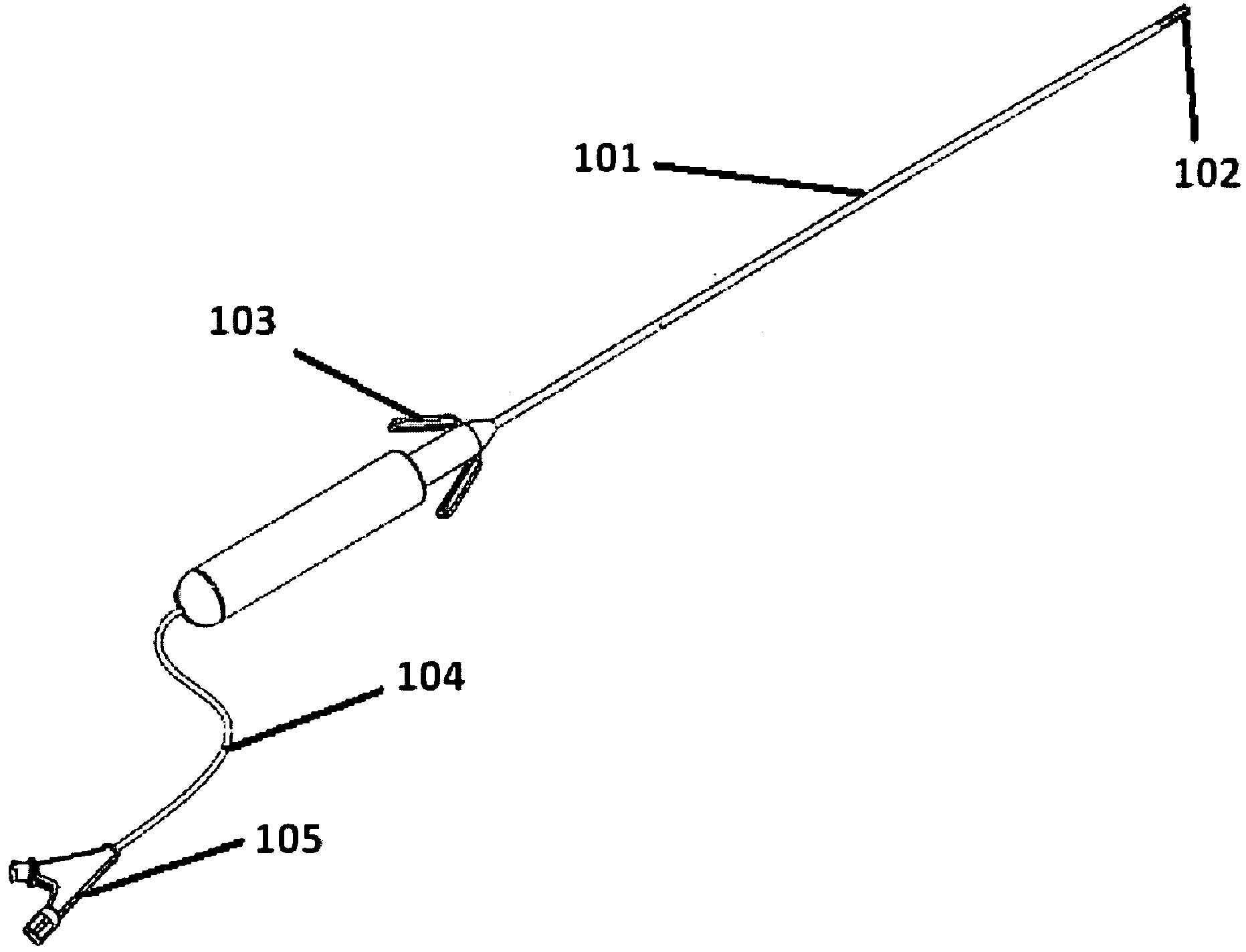 Retrievable urethra sparing prosthetic stent and kidney stone intervention system