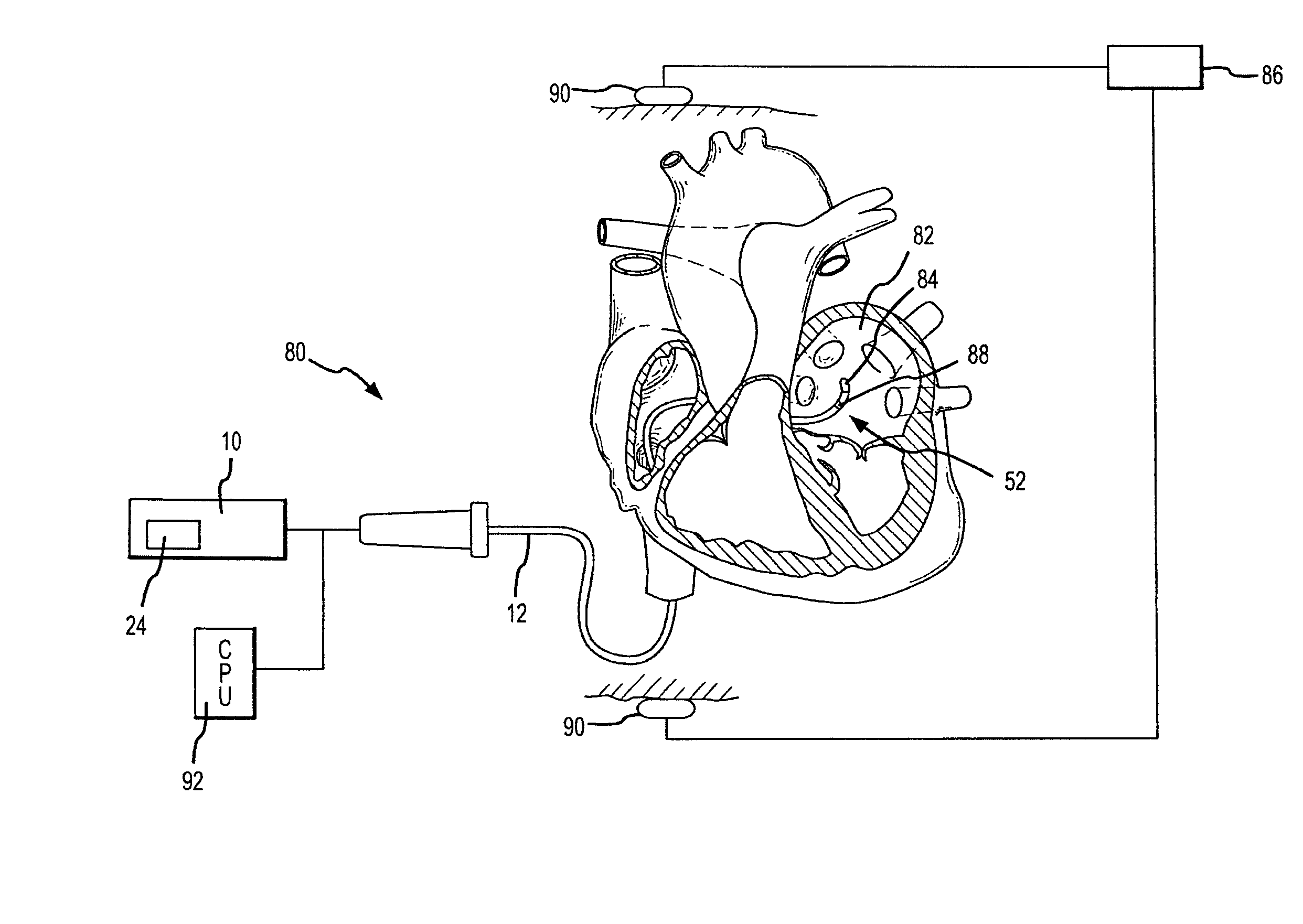 Robotic surgical system and method for surface modeling