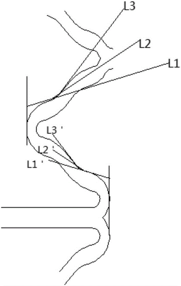 Implanted completely bioresorbable blood vessel polymer support