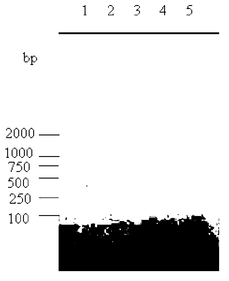 Epoxide hydrolase enzyme gene and encoding enzymeand and carrier and engineering bacteria and application