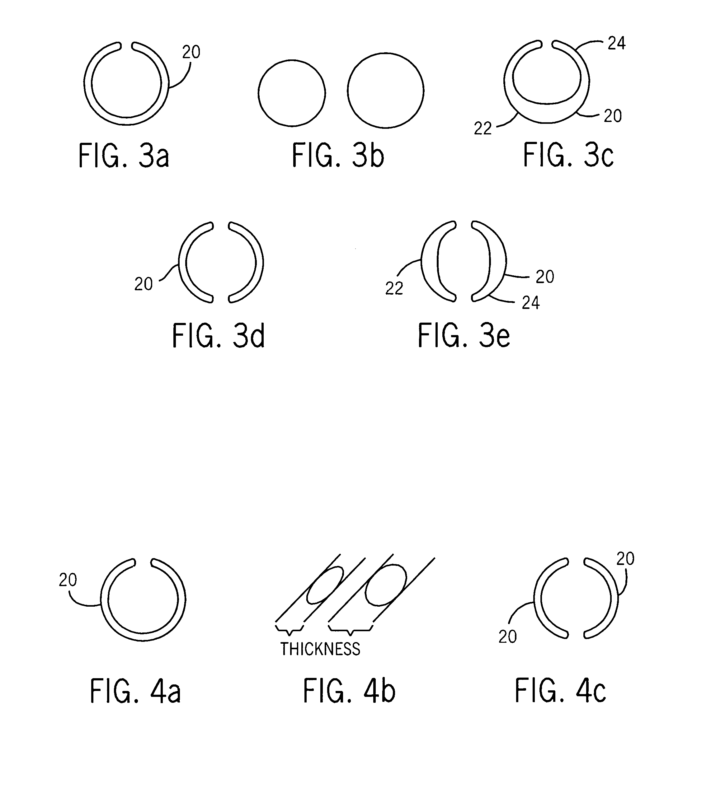 Pre-formed intrastromal corneal insert for corneal abnormalities or dystrophies