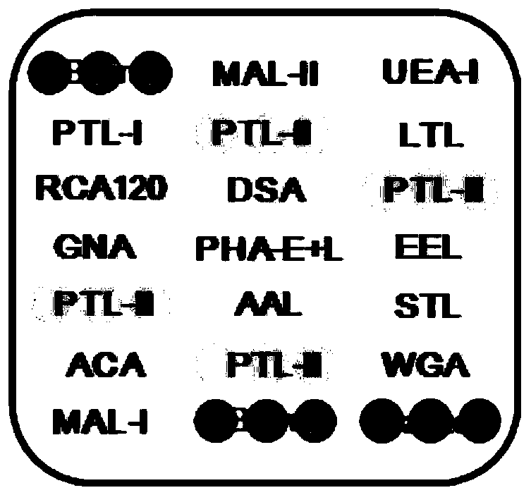 Application of specific lectin combination in construction of test tool for identifying ultra-early liver cancer based on saliva glycoprotein sugar chain