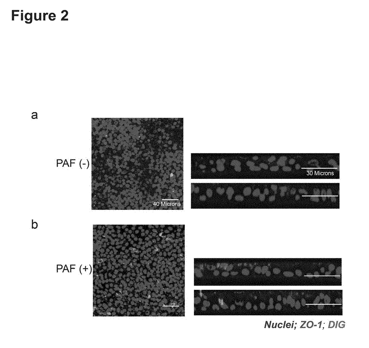 Methods of improving RNAi in well-differentiated airway epithelia