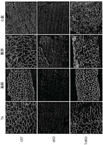 Optimized mini-dystrophin genes and expression cassettes and their use