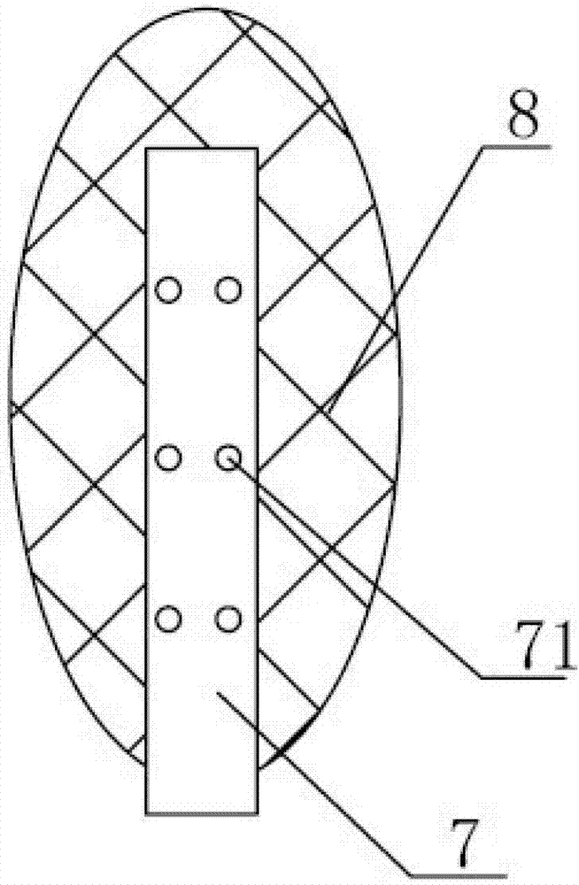 A Transcatheter Implantable Tricuspid Valve Side-to-Side Clamping Device