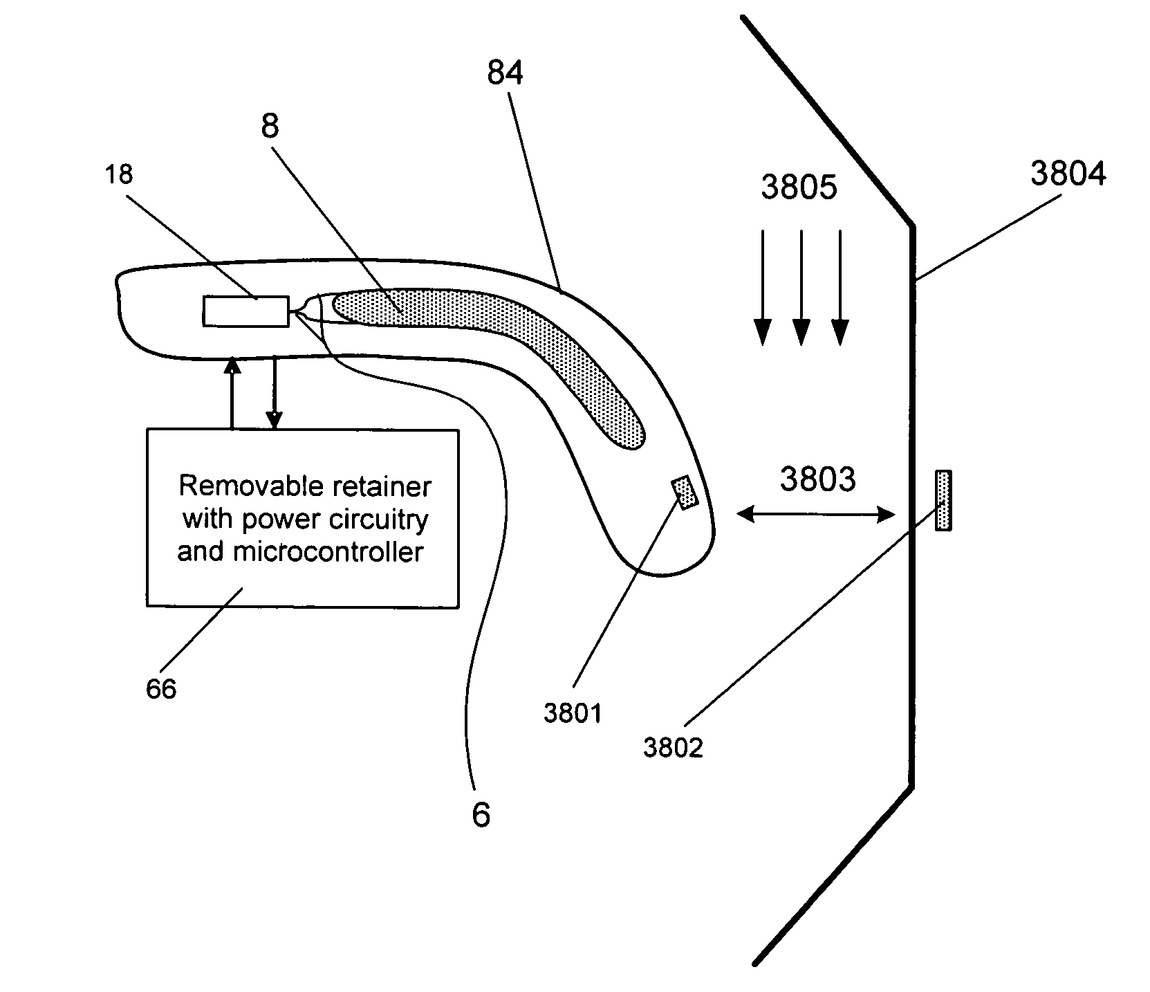 Airway implant sensors and methods of making and using the same