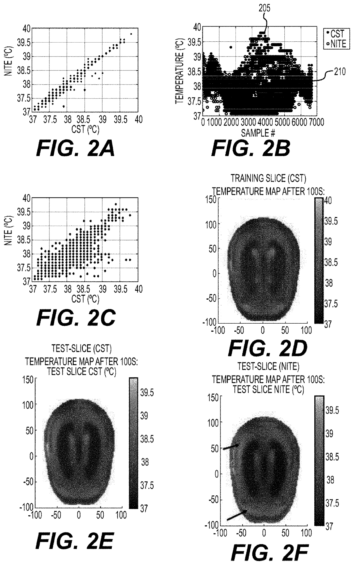 System, method, and computer-accessible medium for non-invasive temperature estimation