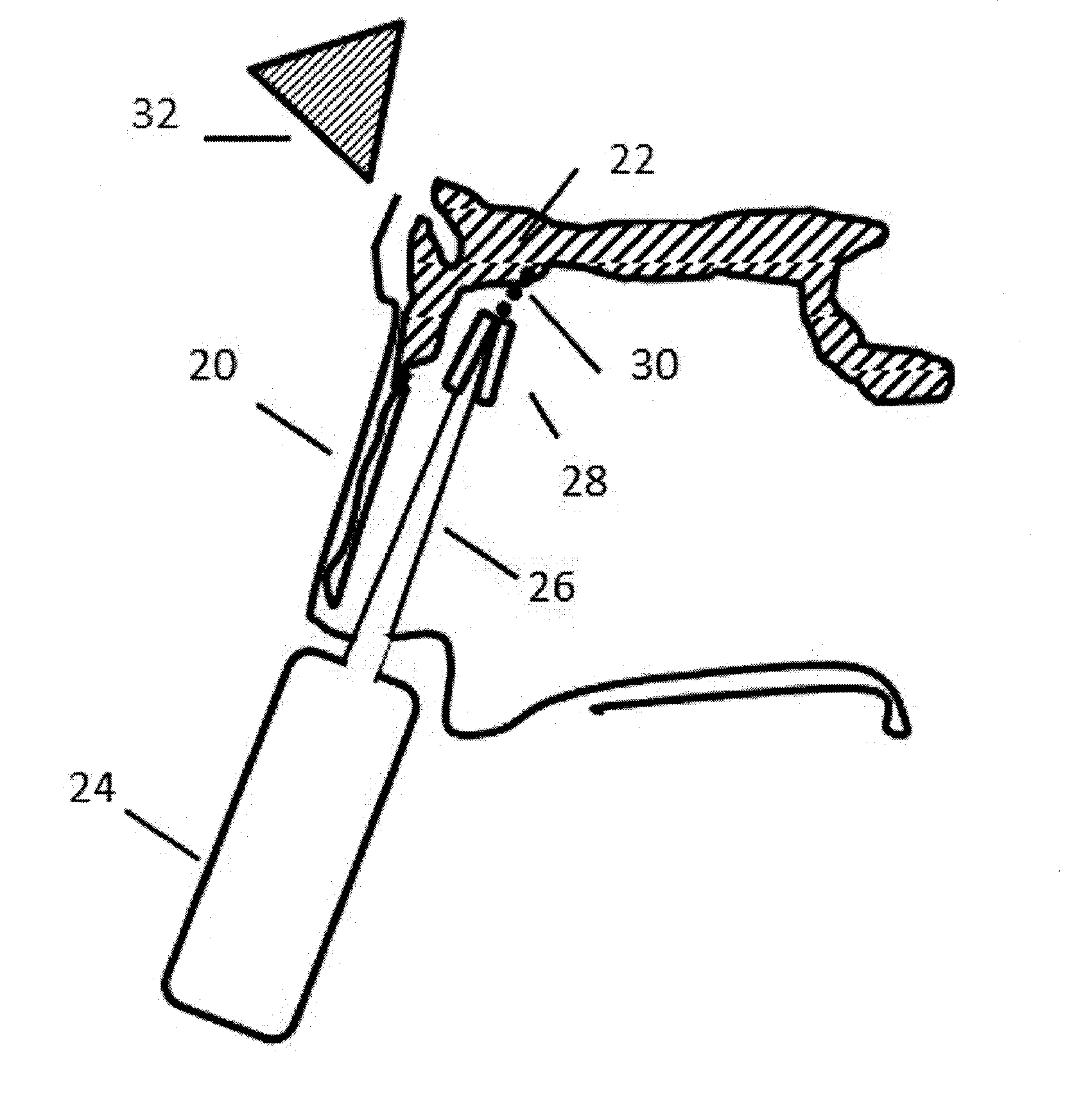 Equipment and methodologies for magnetically-assisted delivery of therapeutic agents through barriers