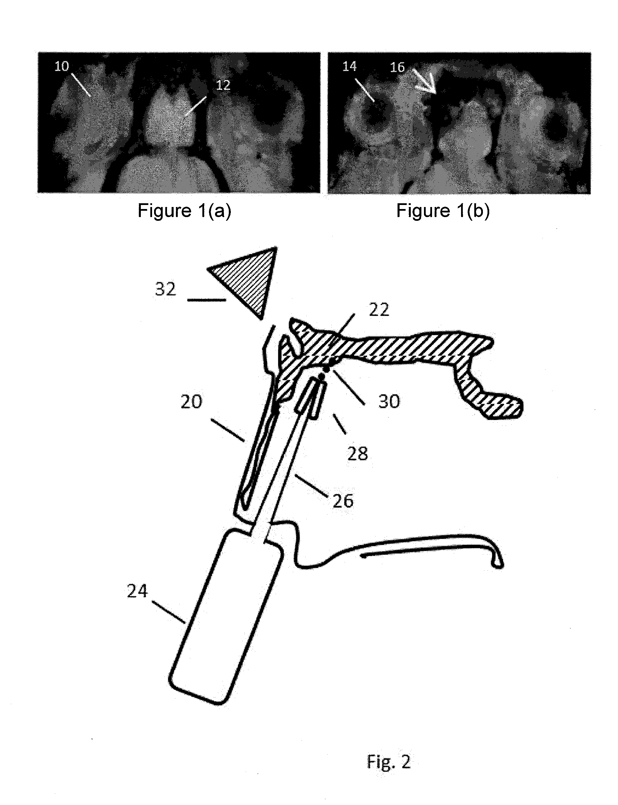 Equipment and methodologies for magnetically-assisted delivery of therapeutic agents through barriers