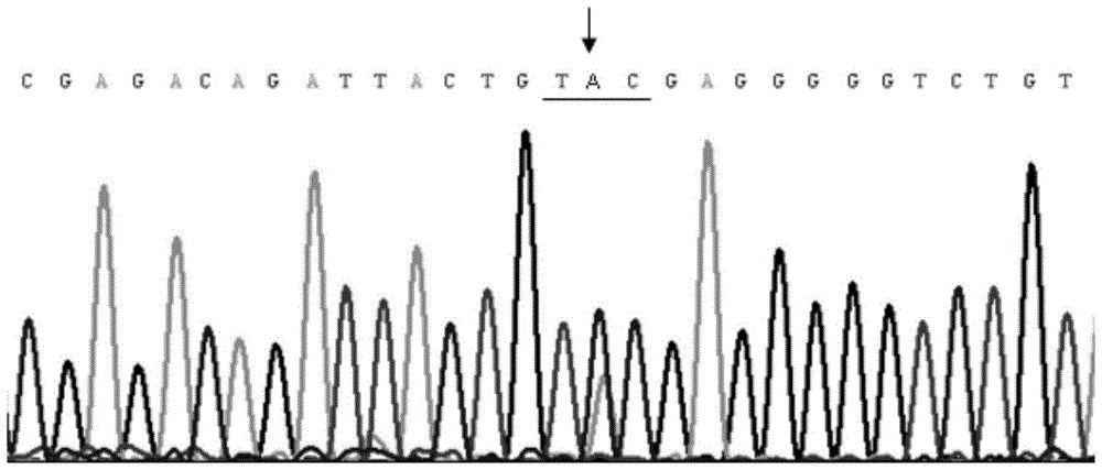 A congenital aniridia causative gene, a kit for detecting the gene and its application