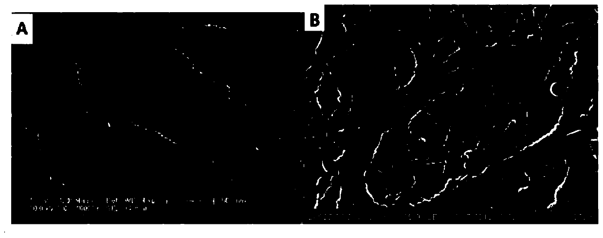 Lithium ion battery diaphragm, preparation method thereof, and lithium ion battery