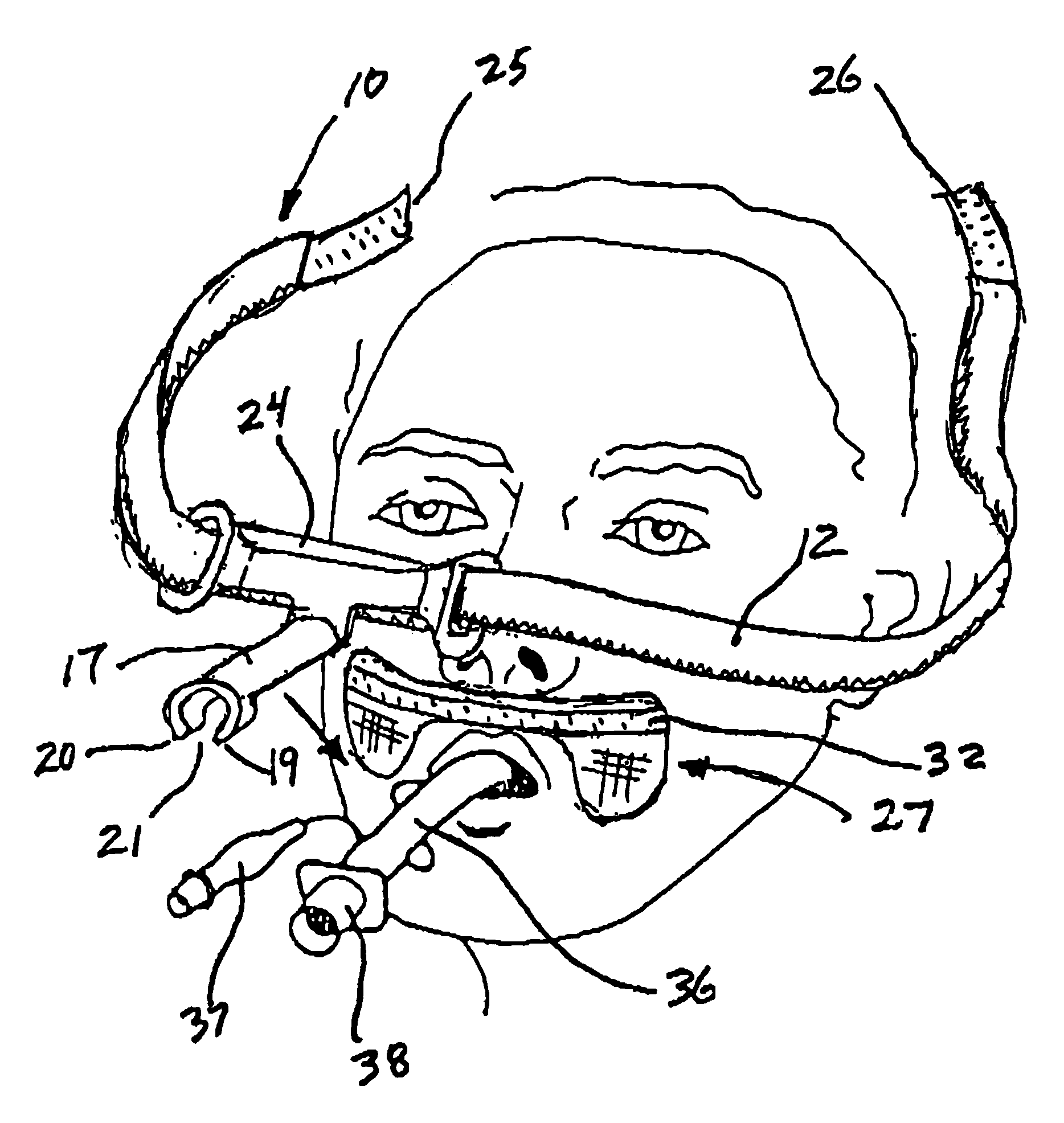 Endotracheal tube holder