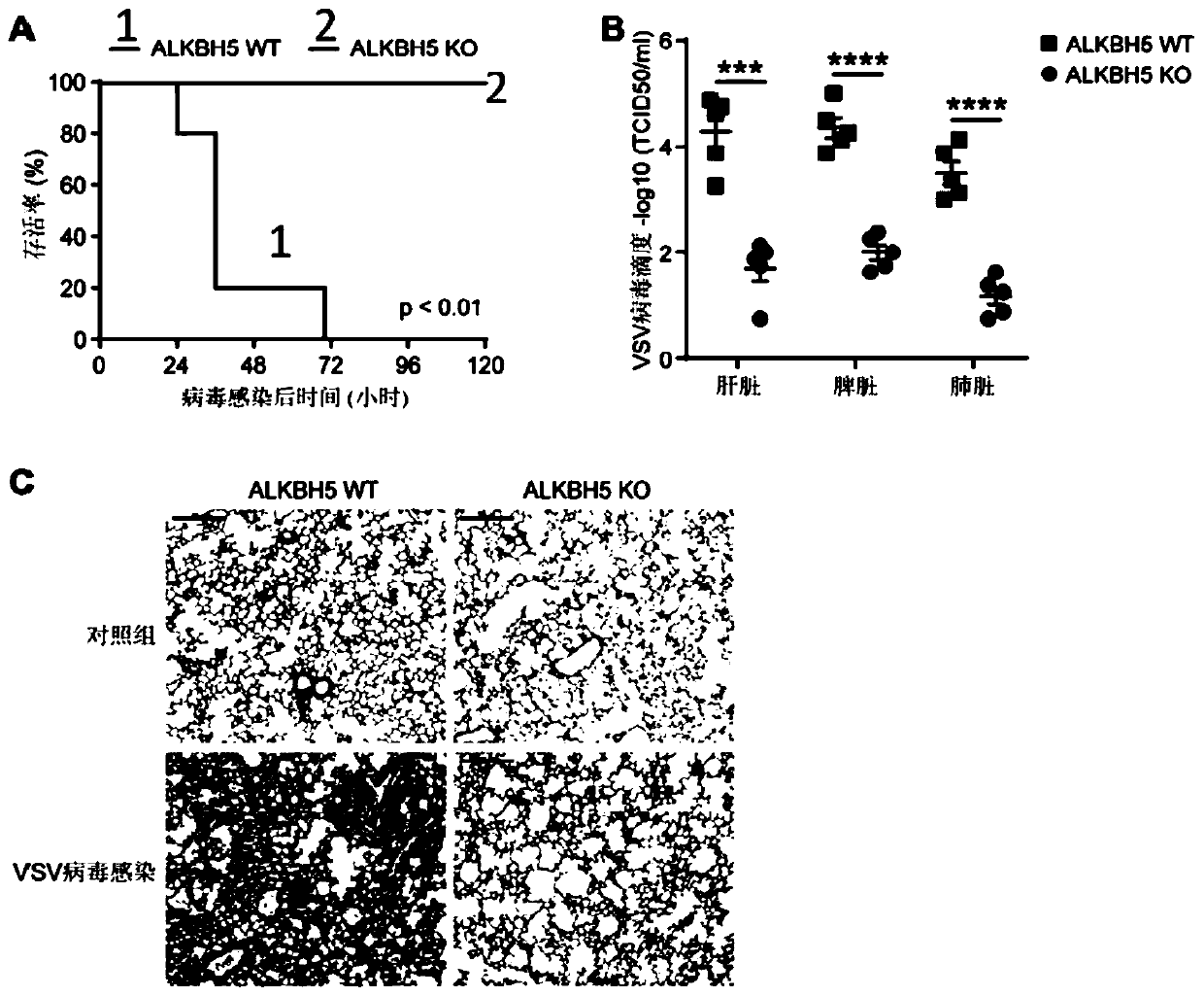 Application of ALKBH5 inhibitor in treatment of virus infectious diseases