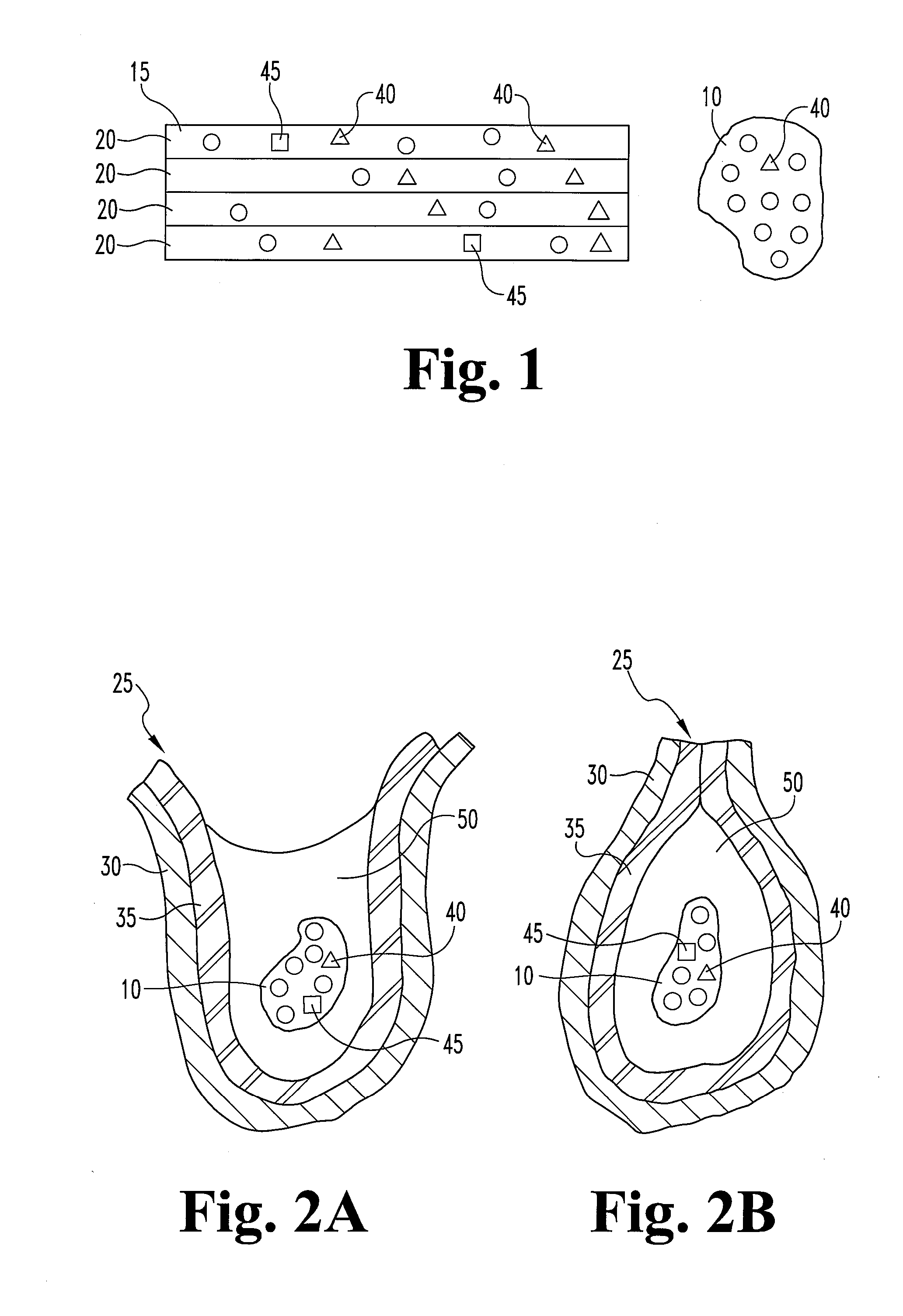 Dried collagenous biomaterial medical device prepared from a urinary tissue source