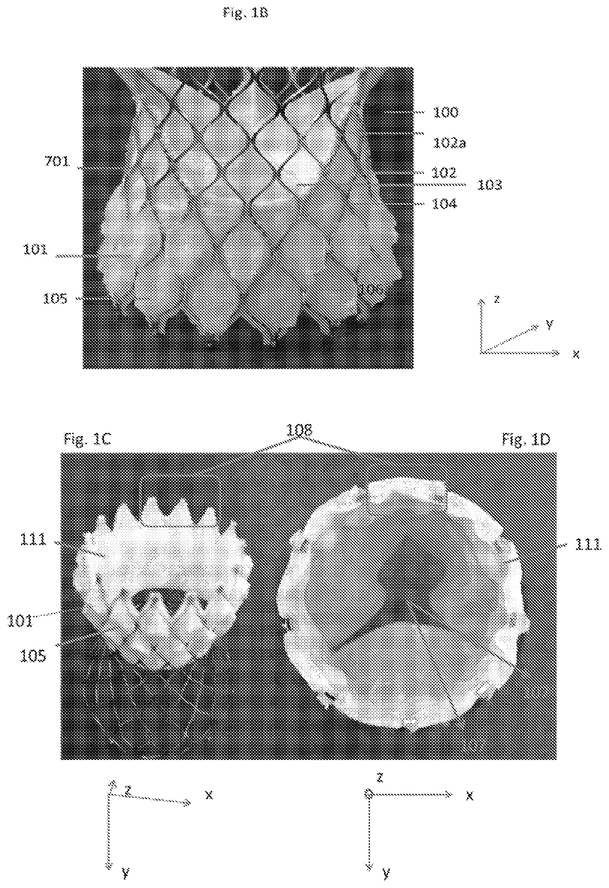 Expandable sealing skirt technology for leak-proof endovascular prostheses