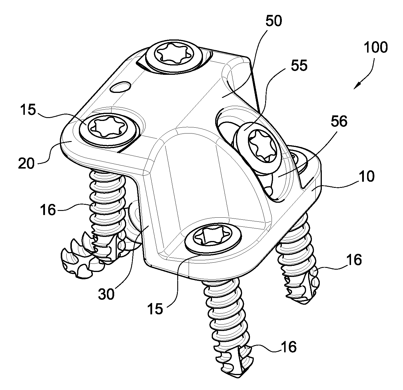 Calcaneus step plate