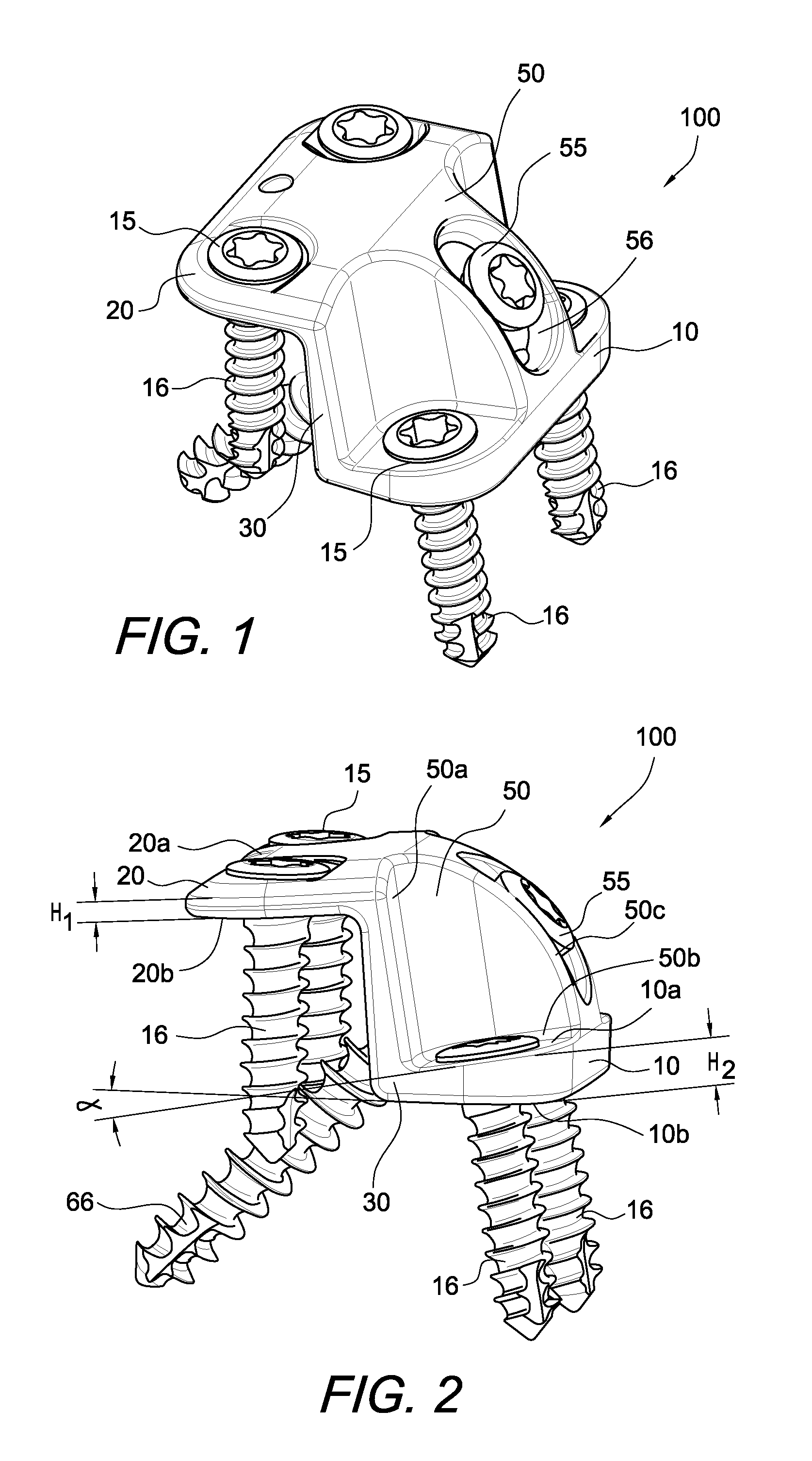 Calcaneus step plate