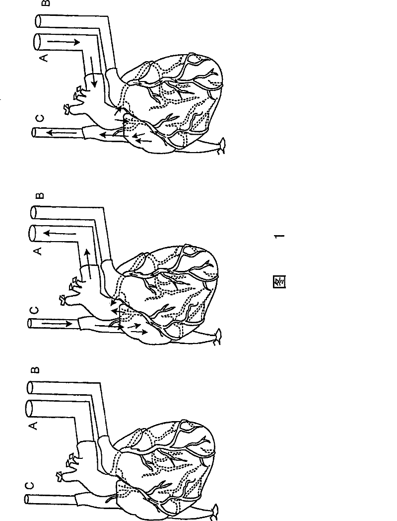 Decellularization and recellularization of organs and tissues