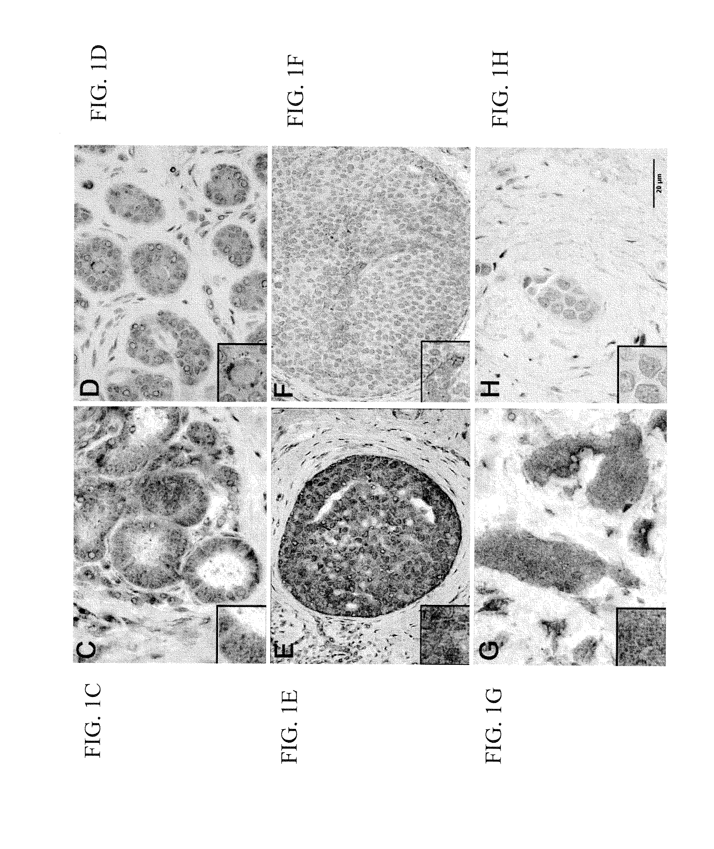 Use of Huntingtin Protein for the Diagnosis and the Treatment of Cancer