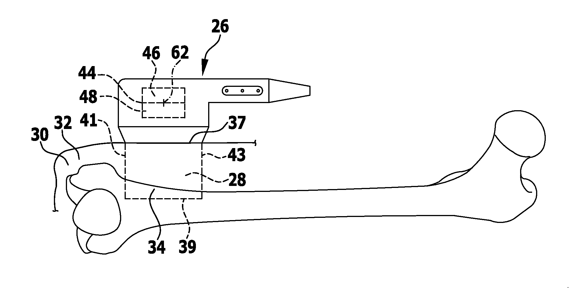 Method and apparatus for displaying an ultrasound image