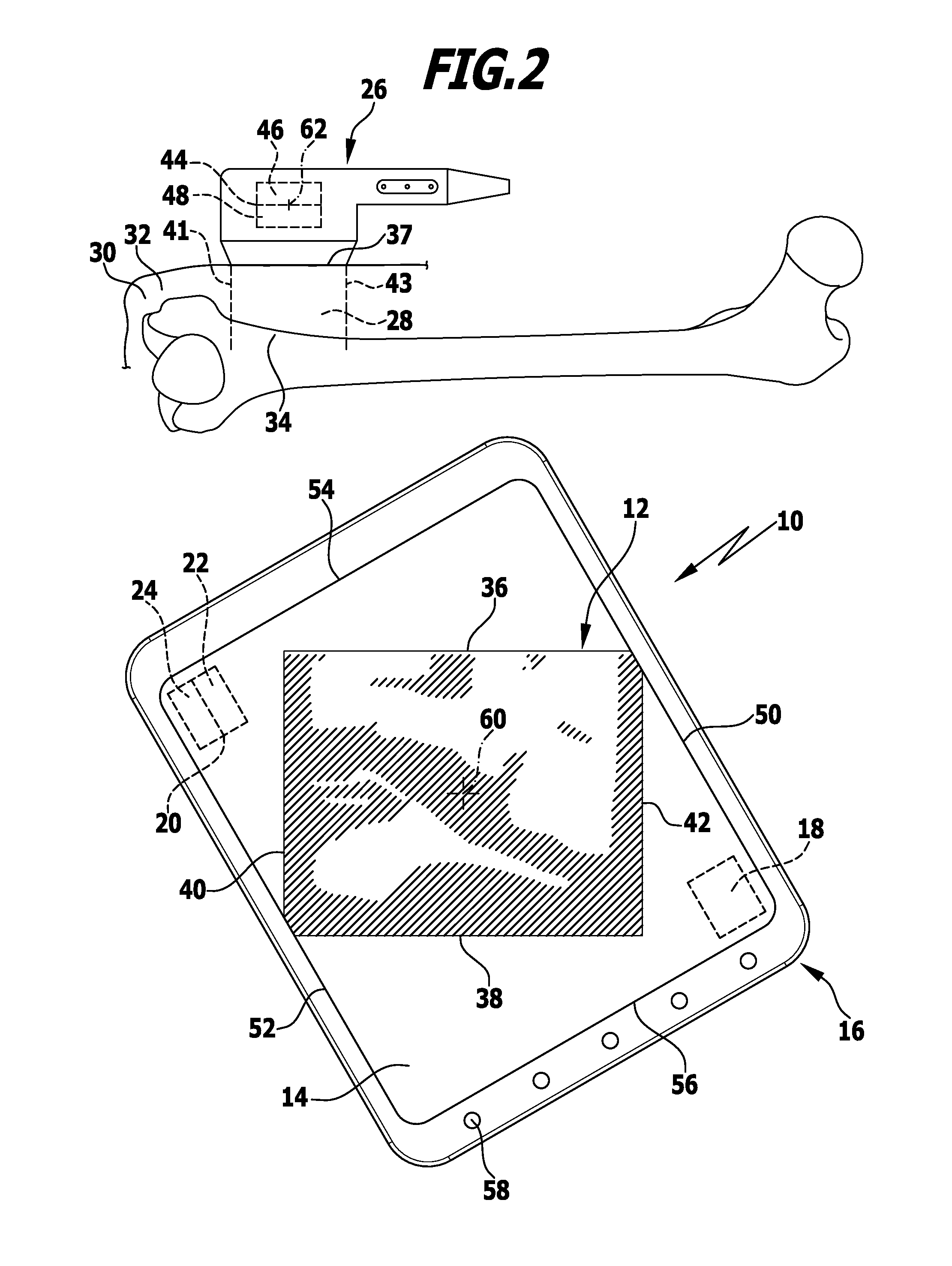 Method and apparatus for displaying an ultrasound image