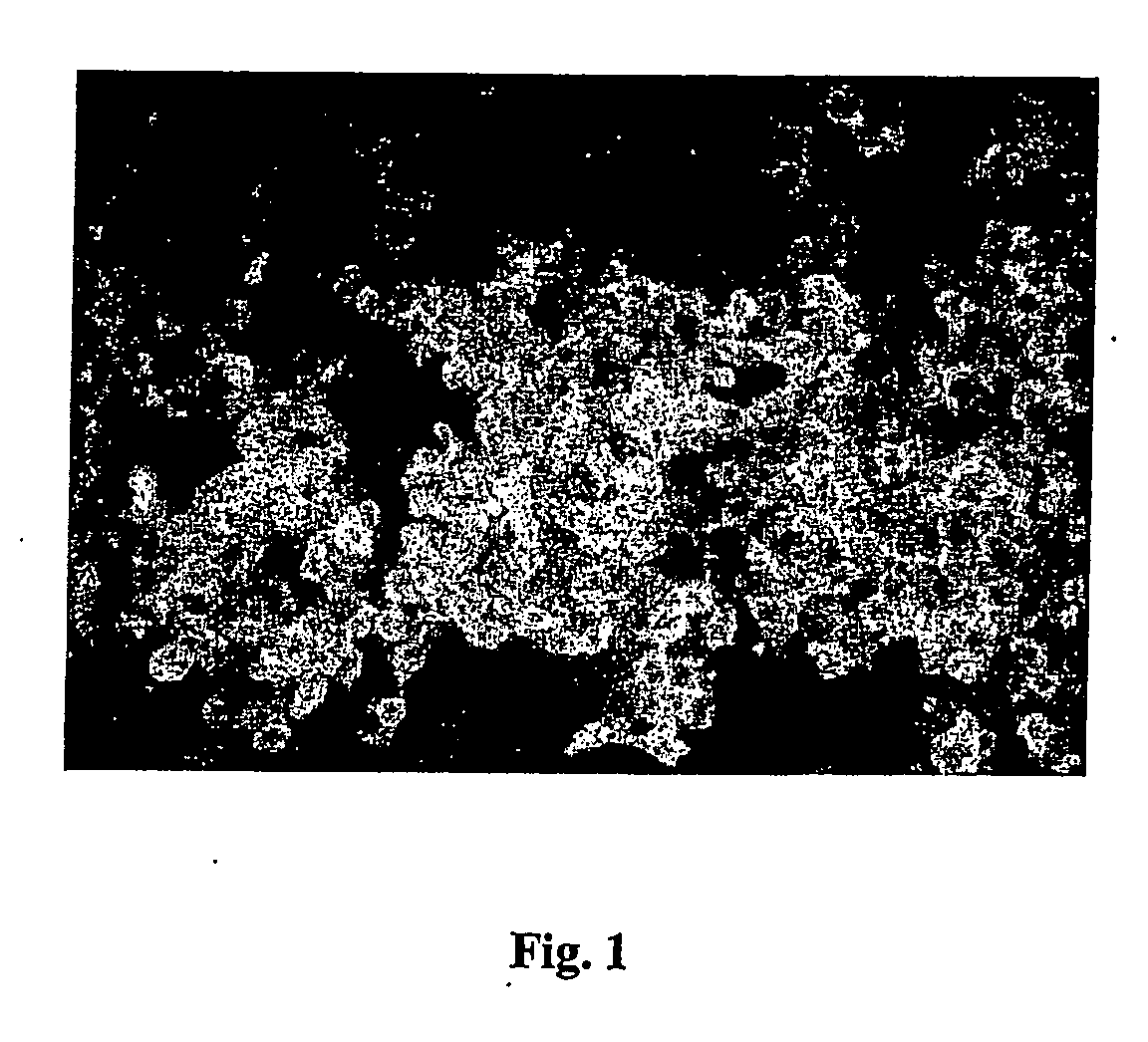 Purified subfragment codifying for neuroaminidase, recombinant neuroaminidase and its use in zooprophylaxis