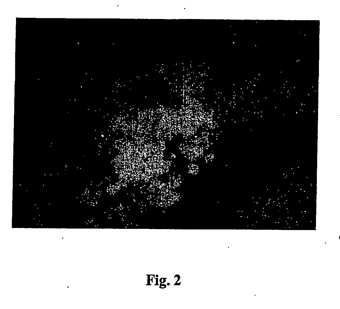 Purified subfragment codifying for neuroaminidase, recombinant neuroaminidase and its use in zooprophylaxis