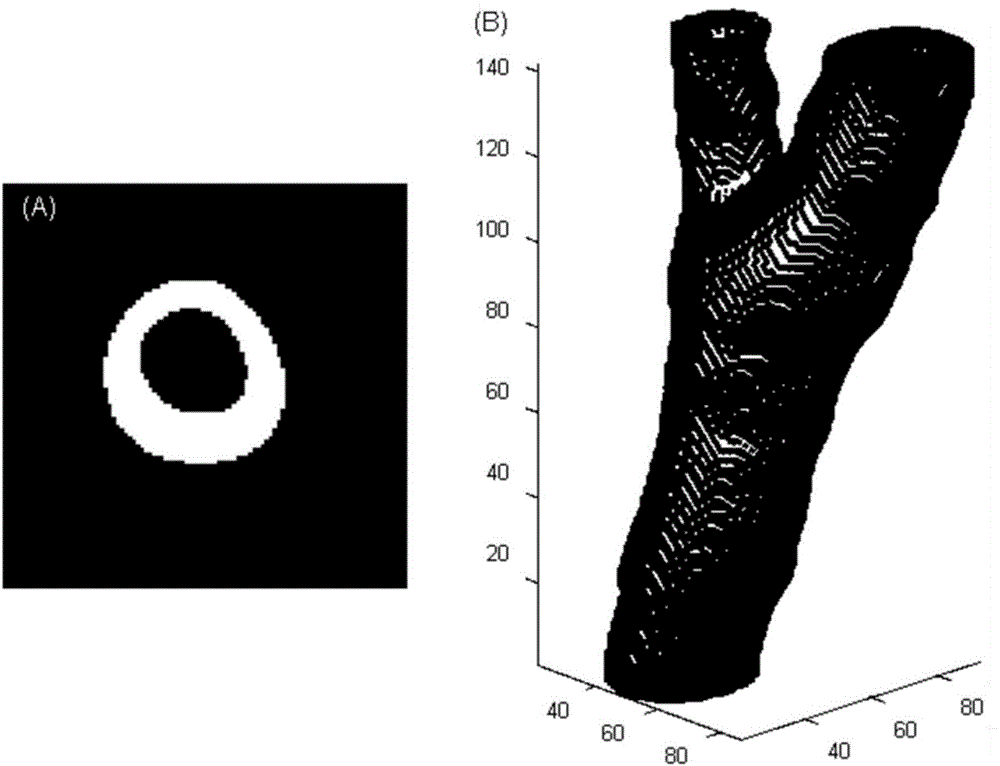 Method for assessing cerebral infarction risk caused by head and neck atherosclerosis plaques