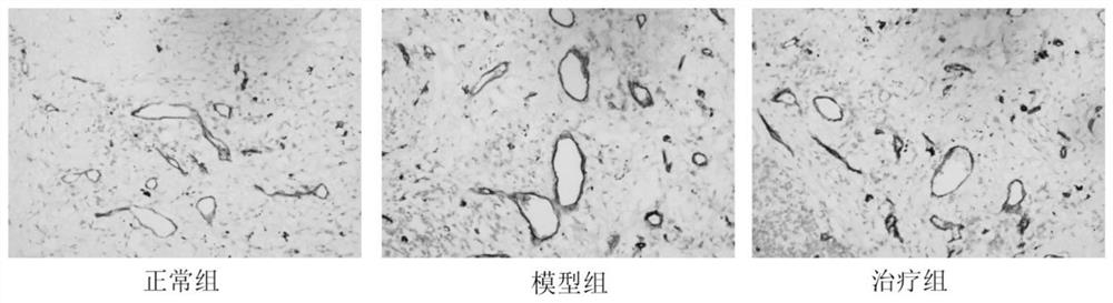 Traditional Chinese medicine composition for treating chronic obstructive pulmonary disease in stable phase and preparation method of traditional Chinese medicine composition