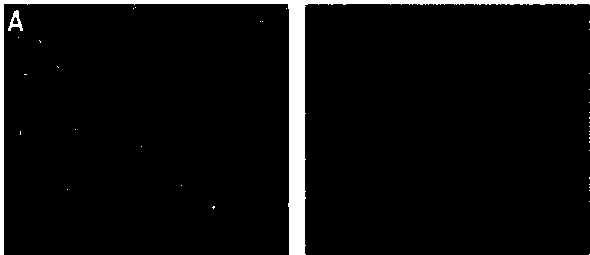 Method for knocking out Endoglin gene by using CRISPR/Cas9 technology