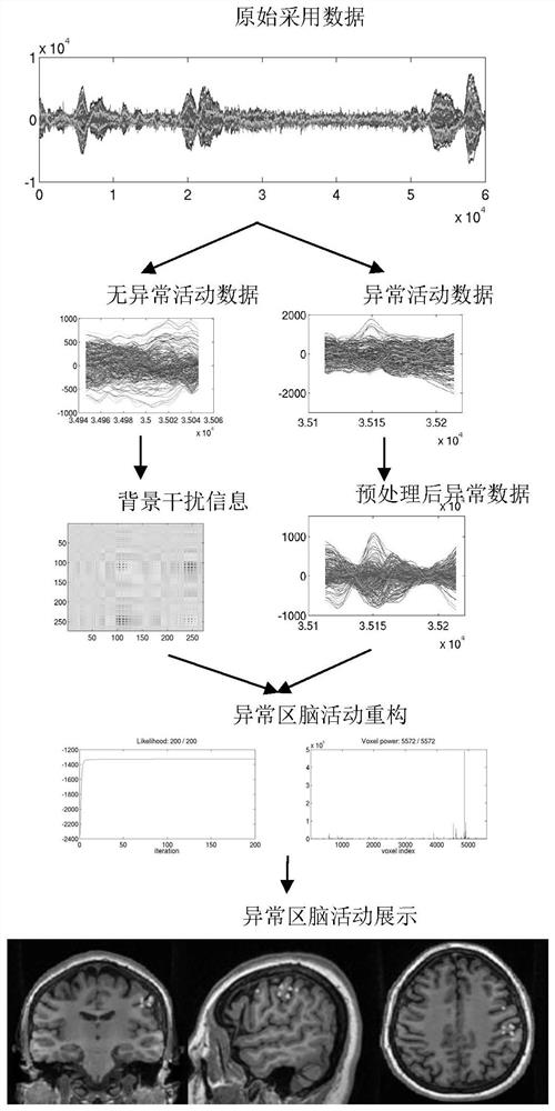 A Bayesian-based imaging system for abnormal brain activity lesions in children