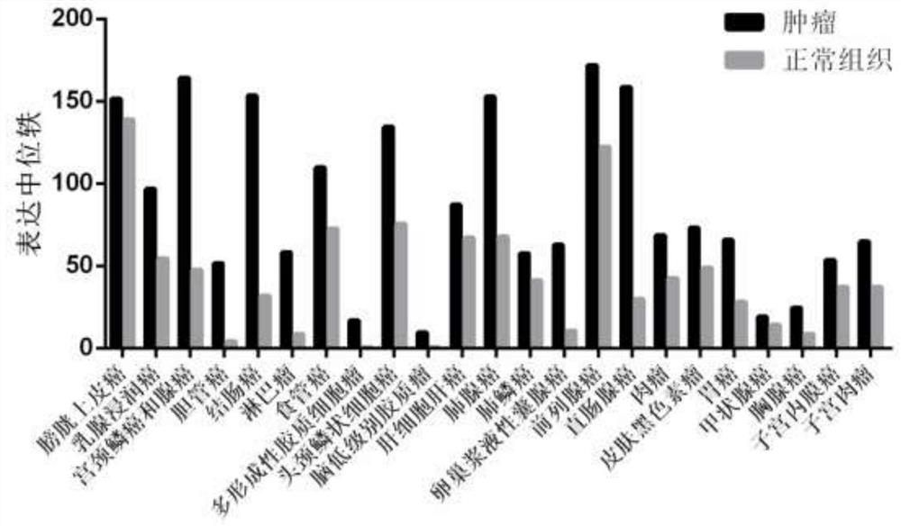 A kind of antineoplastic drug or drug carrier comprising cyclodextrin modified by glutamine