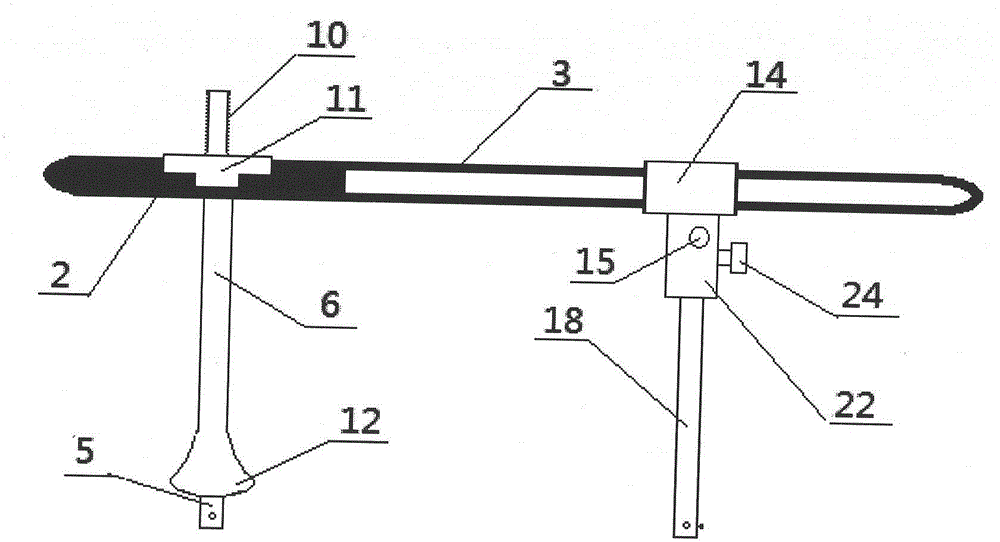 Half-needle assisted replacer for femoral shaft fracture